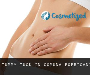 Tummy Tuck in Comuna Popricani