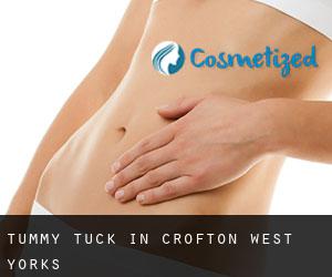 Tummy Tuck in Crofton West Yorks