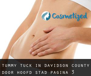 Tummy Tuck in Davidson County door hoofd stad - pagina 3
