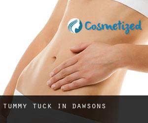 Tummy Tuck in Dawsons
