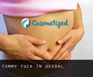 Tummy Tuck in Deeral
