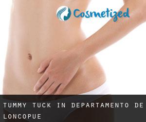 Tummy Tuck in Departamento de Loncopué