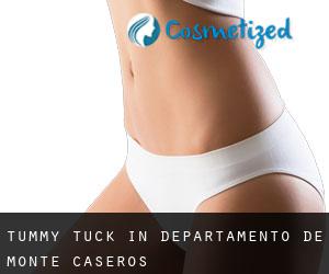 Tummy Tuck in Departamento de Monte Caseros