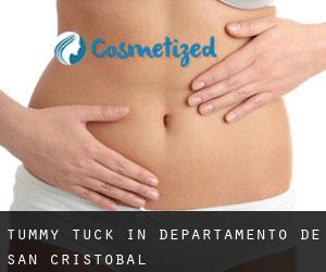 Tummy Tuck in Departamento de San Cristóbal