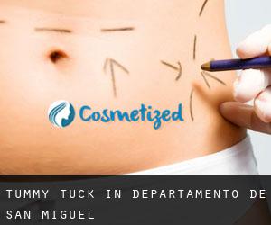 Tummy Tuck in Departamento de San Miguel