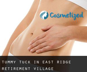 Tummy Tuck in East Ridge Retirement Village