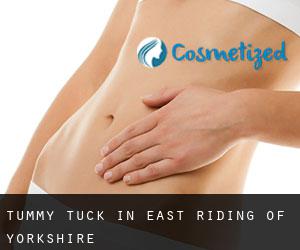 Tummy Tuck in East Riding of Yorkshire