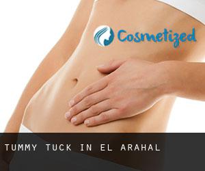 Tummy Tuck in El Arahal
