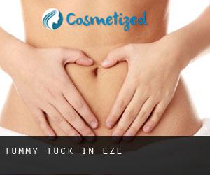 Tummy Tuck in Èze