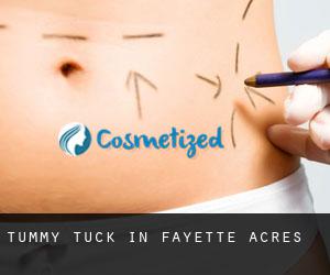 Tummy Tuck in Fayette Acres