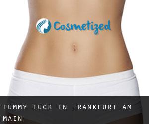 Tummy Tuck in Frankfurt am Main
