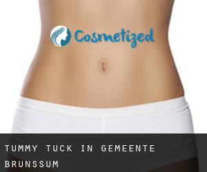 Tummy Tuck in Gemeente Brunssum
