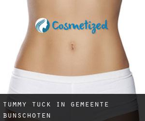 Tummy Tuck in Gemeente Bunschoten