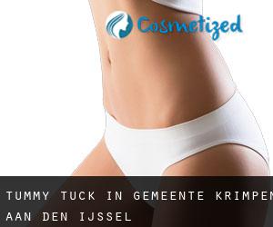 Tummy Tuck in Gemeente Krimpen aan den IJssel