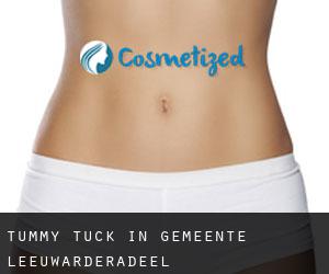 Tummy Tuck in Gemeente Leeuwarderadeel