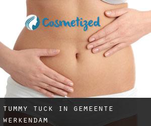 Tummy Tuck in Gemeente Werkendam
