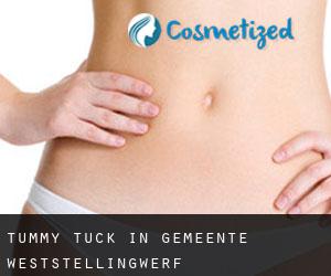Tummy Tuck in Gemeente Weststellingwerf