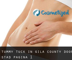 Tummy Tuck in Gila County door stad - pagina 1