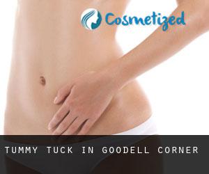 Tummy Tuck in Goodell Corner