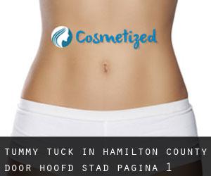 Tummy Tuck in Hamilton County door hoofd stad - pagina 1