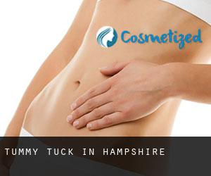 Tummy Tuck in Hampshire Tummy Tuck in Hampshire