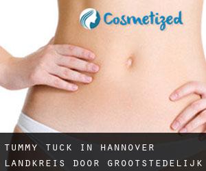 Tummy Tuck in Hannover Landkreis door grootstedelijk gebied - pagina 1