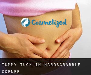 Tummy Tuck in Hardscrabble Corner