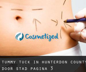 Tummy Tuck in Hunterdon County door stad - pagina 3