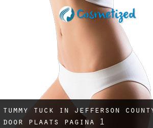 Tummy Tuck in Jefferson County door plaats - pagina 1