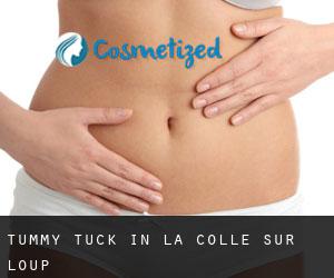 Tummy Tuck in La Colle-sur-Loup