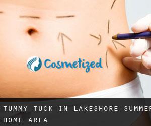 Tummy Tuck in Lakeshore Summer Home Area