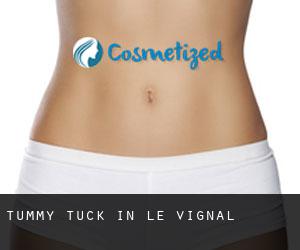 Tummy Tuck in Le Vignal