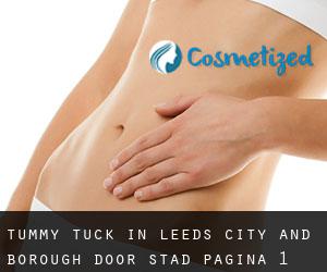 Tummy Tuck in Leeds (City and Borough) door stad - pagina 1