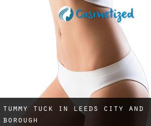 Tummy Tuck in Leeds (City and Borough)