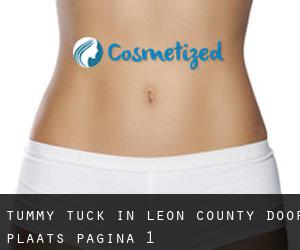 Tummy Tuck in Leon County door plaats - pagina 1