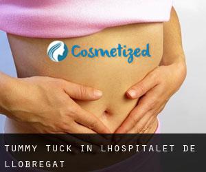 Tummy Tuck in L'Hospitalet de Llobregat