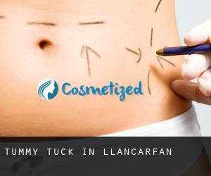 Tummy Tuck in Llancarfan