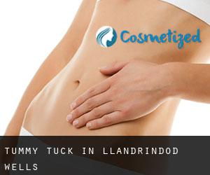 Tummy Tuck in Llandrindod Wells