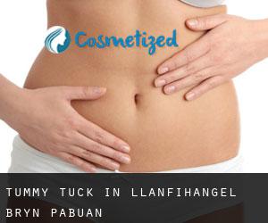 Tummy Tuck in Llanfihangel-Bryn-Pabuan