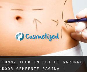 Tummy Tuck in Lot-et-Garonne door gemeente - pagina 1