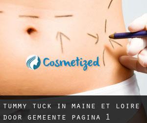 Tummy Tuck in Maine-et-Loire door gemeente - pagina 1