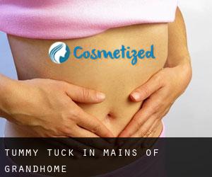 Tummy Tuck in Mains of Grandhome