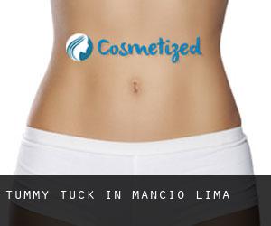 Tummy Tuck in Mâncio Lima