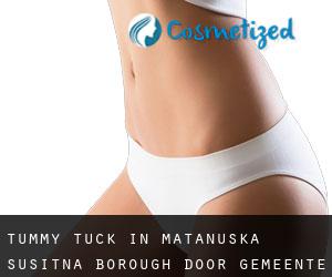 Tummy Tuck in Matanuska-Susitna Borough door gemeente - pagina 1
