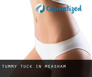 Tummy Tuck in Measham