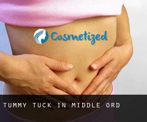 Tummy Tuck in Middle Ord