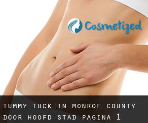 Tummy Tuck in Monroe County door hoofd stad - pagina 1