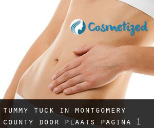 Tummy Tuck in Montgomery County door plaats - pagina 1
