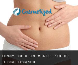 Tummy Tuck in Municipio de Chimaltenango