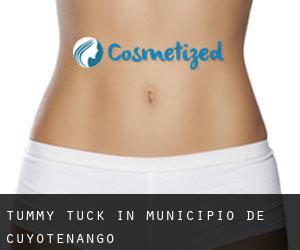 Tummy Tuck in Municipio de Cuyotenango